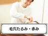 毛穴汚れ×小顔ケア◎美容鍼＋毛穴洗浄¥14000→¥7980