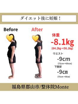 整体院 モンテ(monte)/before＆after