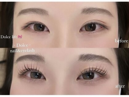 ドルチェ 大財店(Dolce)の写真