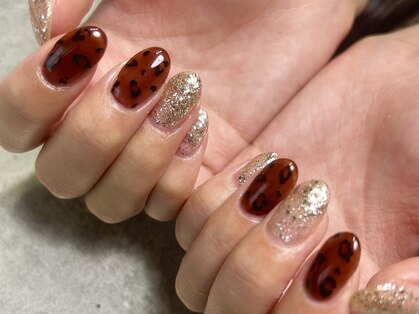 ブラウンネイル(brown nail)の写真