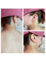 サロンアンドスクール ローズマリー (Salon&School Rosemary)/全身脱毛(光脱毛)