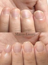 マリーロール 淀屋橋本店(Marie Laure)/自爪育成/深爪矯正/ネイルケア