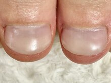 グレースレディ 大阪店/マムシ爪にも