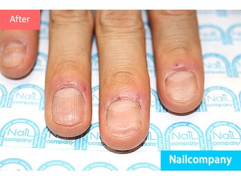 ネイルカンパニー/