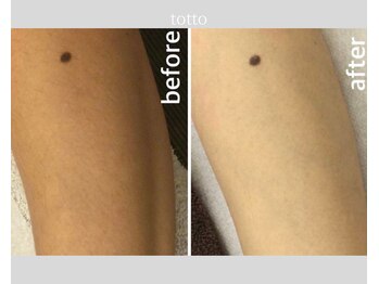 サロントット(salon totto)/before→after