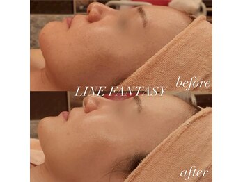 ラインファンタジー 武庫之荘店