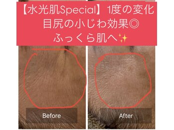 アスボーテ 月島(As Beaute’)/1Day水光肌specialの効果！