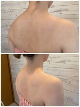 サロン ド プロデュース(salon de PRODUCE)/若見えスッキリ背中に◎