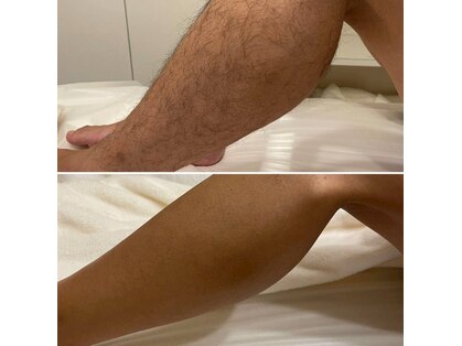 エクシア(excia)の写真