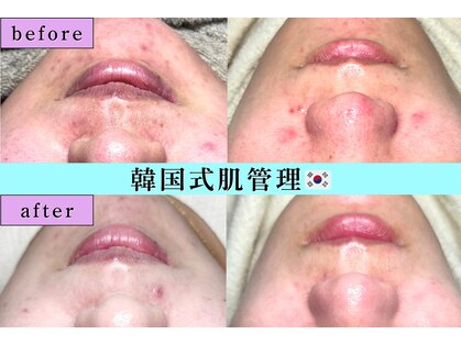 ディエール(Diailes)の写真