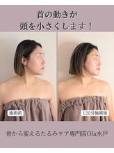 オラ(Ola)/30代/1回目施術後
