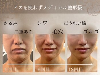 ゴールデンケア(goldencare)/【Vリフト】＋７Dコルギ＋頭矯正