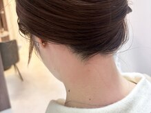 ピミル(PIMIL)/うなじ脱毛