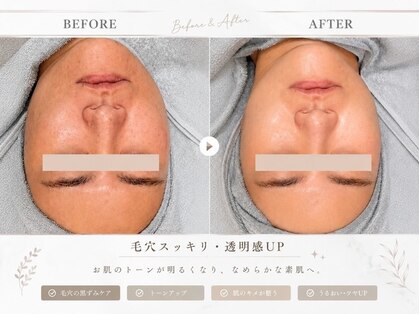 シロ(shiro)の写真