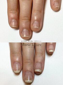 マリーロール 梅田店(Marie Laure)/自爪育成/深爪矯正/ネイルケア
