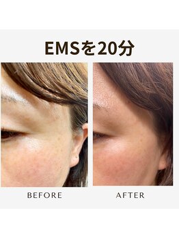 プレジール(plaisir)/しわの改善もご相談ください