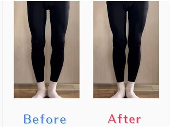 ザ コンディショニングルーム コガオスタジオ 自由が丘店(KOGAOSTUDIO)/ビフォーアフター　O脚