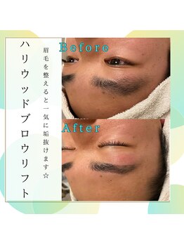 ソラ(SORA)/