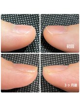 カラーネイルスタジオ(Callanail studio)/地爪育成♪