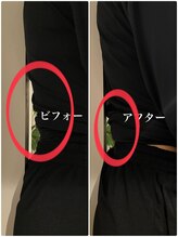 クラーレ(CURARE)/【ビフォー、アフター】