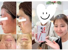 アンシャンテ 神戸元町店(Enchante)の雰囲気（剥離しない低刺激ピーリングが人気◎毛穴やニキビのお悩み解決◎）