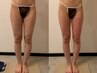 【美脚＆美尻コース】硬いセル脂肪を撃退！内ももに隙間を作る！浮腫改善〇