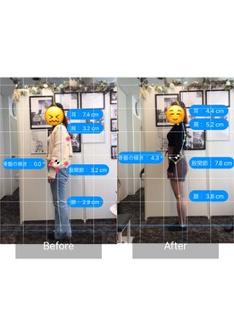 ナオル整体 目黒院(NAORU整体)/before/after(目黒/整体)