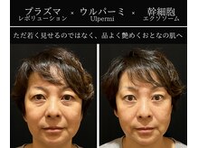 小顔ウナ学芸大学店(UNA)