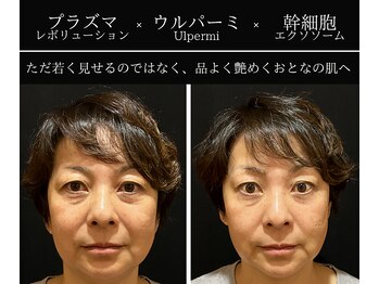 小顔ウナ学芸大学店(UNA)