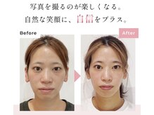 真美(Sinbi)の雰囲気（本来の姿へ♪すっぴん美人に早変わり！）