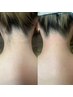 薄着に備えて【WAX脱毛】うなじ+αトップスから見える範囲までOK