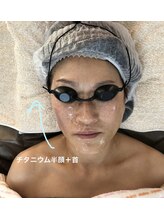 アルページュ(Arpege)/半顔に照射でギュッとリフト！