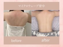 ラボーテアッシュ(La beaute H)/マイクロウェーブ背中