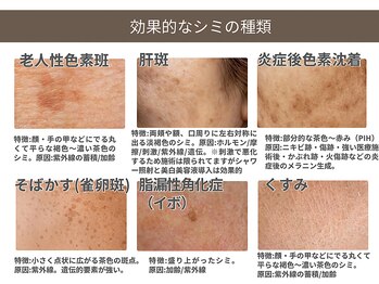 ザ フロウ(THE flow)/当店でケアできるシミの種類