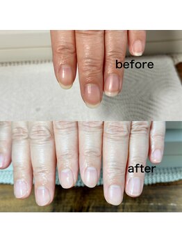 ホームサロン エヌスリー(N3)/綺麗な自爪に大変身