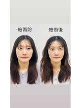 赤沼鍼灸整骨院/美・健康・笑顔に導く美容鍼