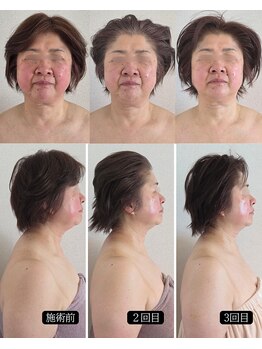 オラ(Ola)/60代/3回の軌跡