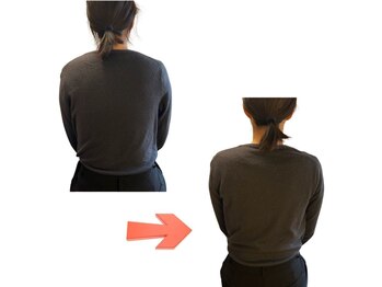 シゼン(Shizen)/ビフォーアフター