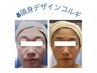 【たるみ改善】ほうれい線、フェイスライン引き上げコルギ27500円→9900円