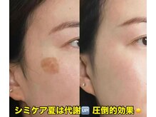 東洋経絡エステ アンド リラクゼーション/【お肌一回で実感できます】