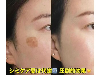 東洋経絡エステ アンド リラクゼーション/【お肌一回で実感できます】