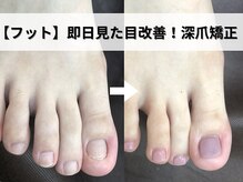 深爪矯正専門ネイルサロン アニューの雰囲気(フットネイルの形を整えたい方も多数ご来店即日サンダル履ける)