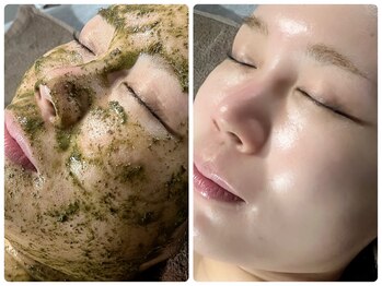 ジェミニ フェイス デザイン(Gemini Face Design)/REVIハーブピーリング☆