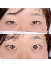 バブルガム(Bubble gum)/【まつ毛パーマ】Before・After