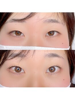 バブルガム(Bubble gum)/【まつ毛パーマ】Before・After