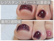 ロコ ファーム(loco farm)/レジスタンスプレート