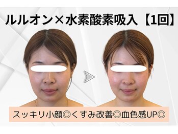 ヨサパーク ラ ぺ(YOSAPARK La paix)/二日酔いもサヨナラ♪