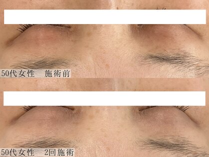 ヴェルシック(Belchic)の写真