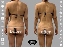 ソウソウビューティー 五反田(Shou Shou Beauty)/ビフォー☆アフター