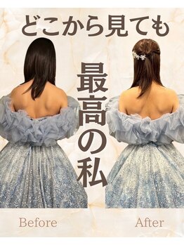 東広島あい整体院/【二の腕】印象に激変★